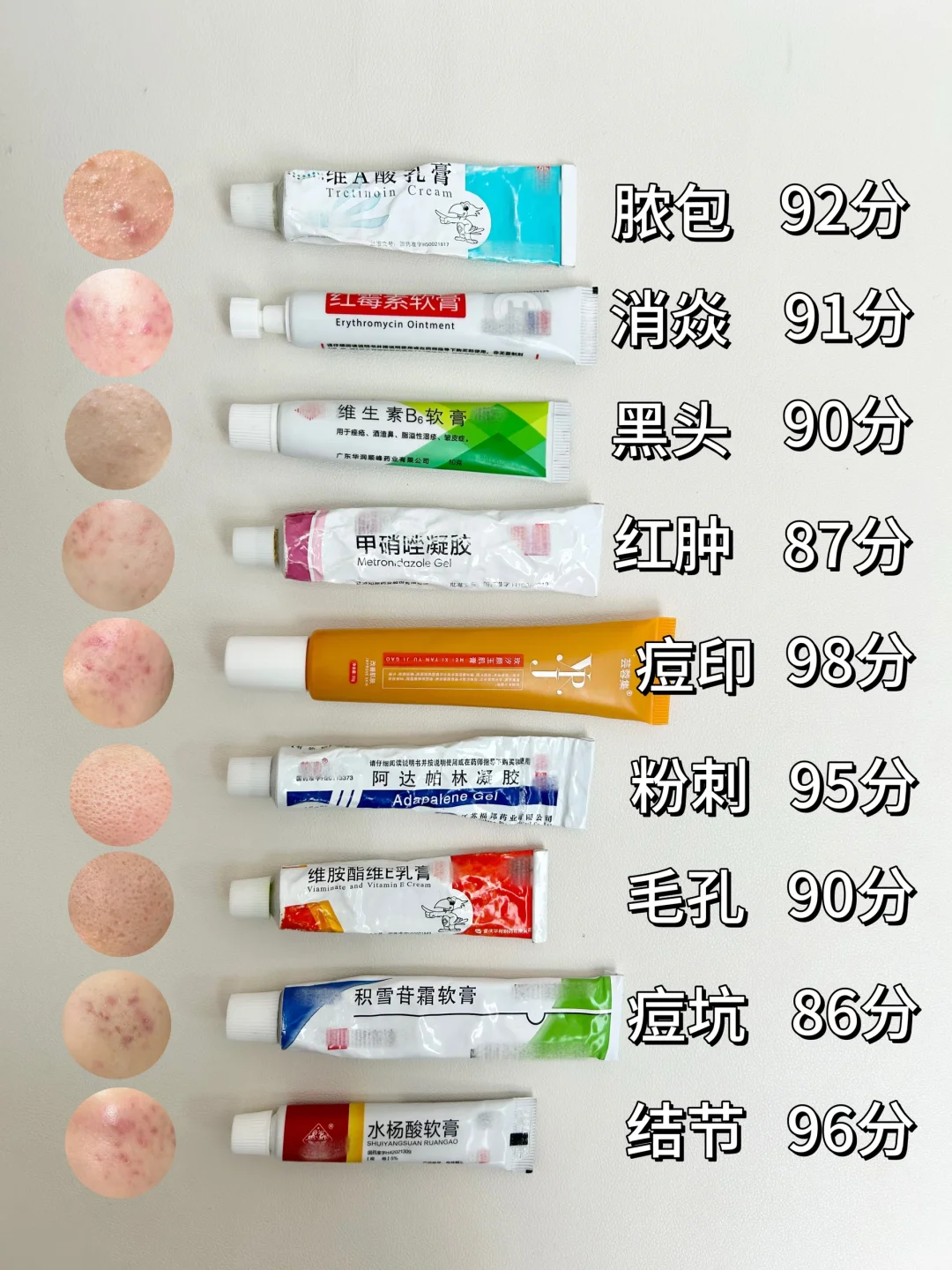 跪服了！重度痘印不看就亏了！！