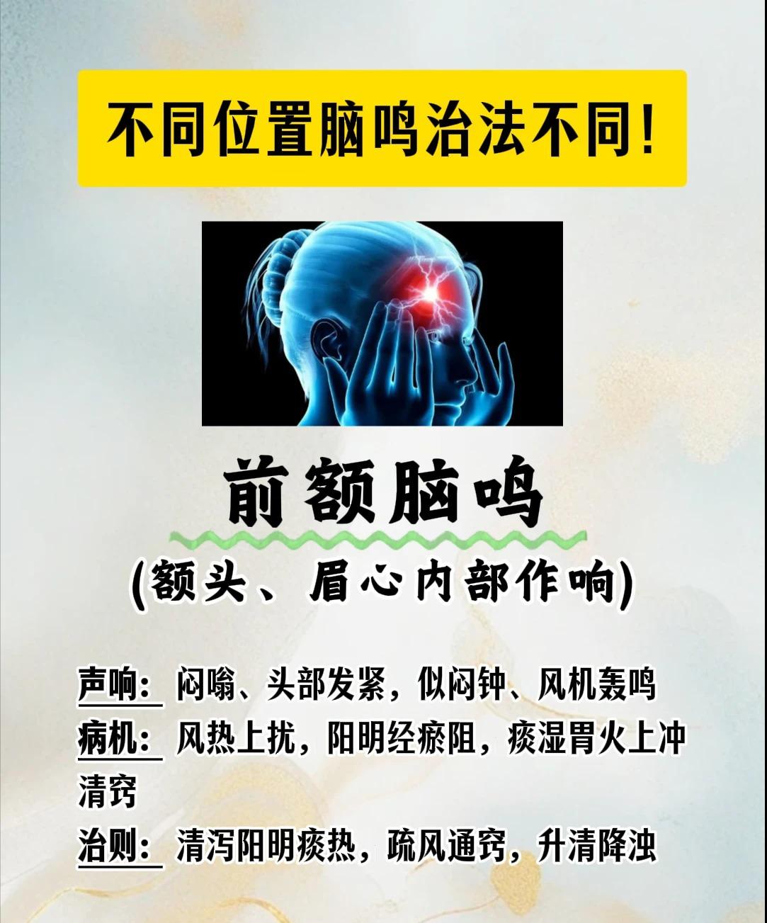 脑鸣发作位置不一样，调理思路也大有区别