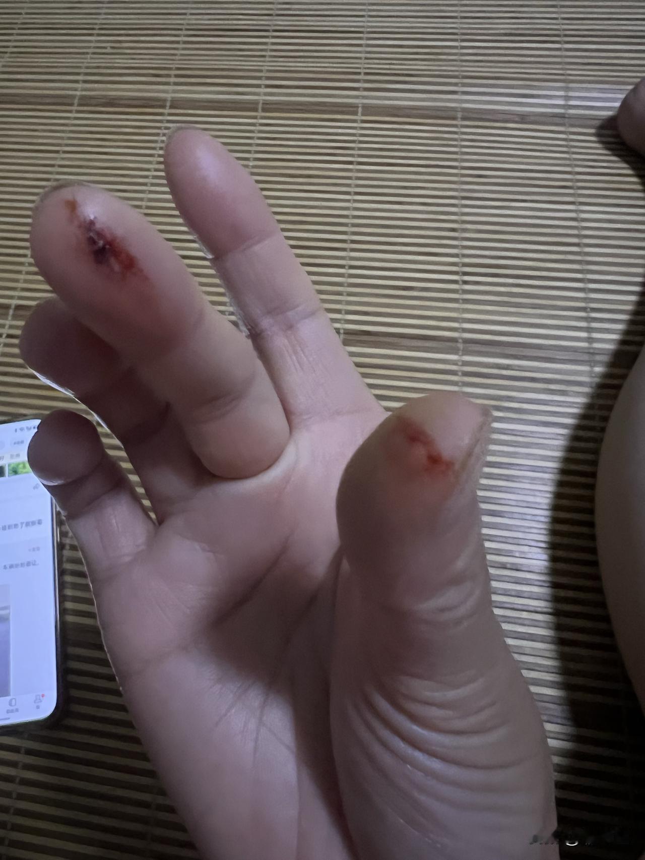 别看秋意凉凉，🦟还在四处逃窜和人的血

刚才准备睡觉觉了，蚊子在我的脸上飞来飞