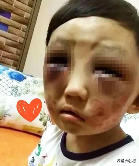 父母离婚后，
6岁的儿子跟着爸爸生活。
这天傍晚，孩子突然出现在妈妈家门口，小脸