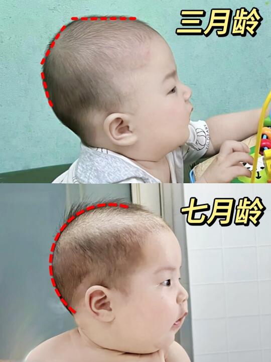 辣妈育儿经｜1+1速成小圆头攻略