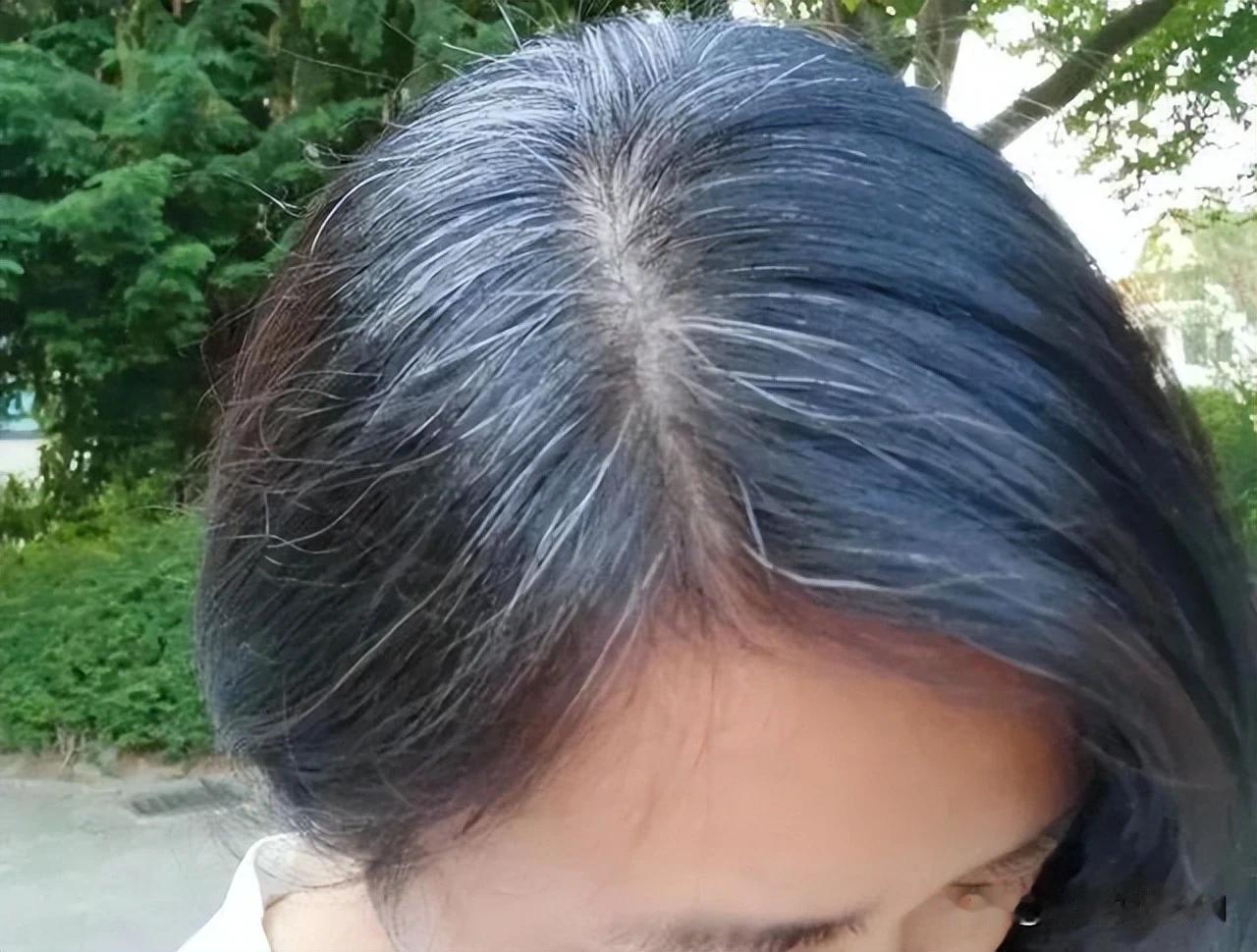 白发不再愁，三穴刮一刮，黑发重现不是梦！

你是否曾为白发增多而烦恼？是否曾羡慕
