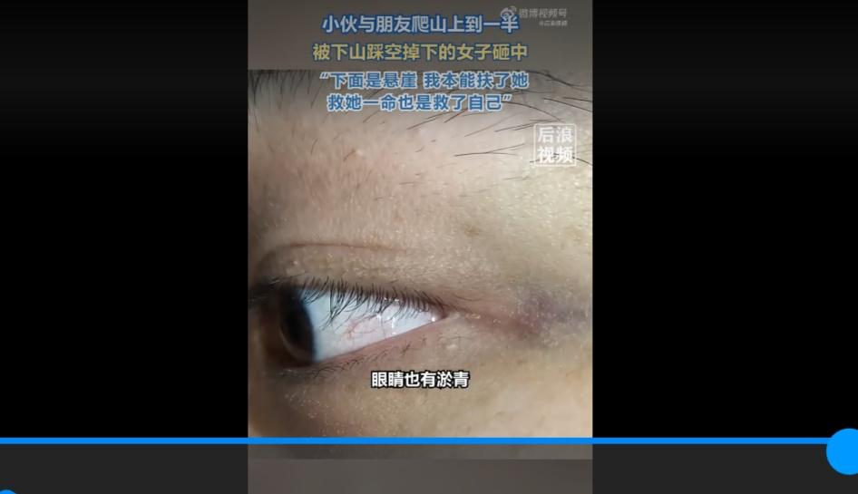 温暖瞬间！！
11月29日，广西桂林。女子下山时不慎踩空摔下，砸中正在上山的两名