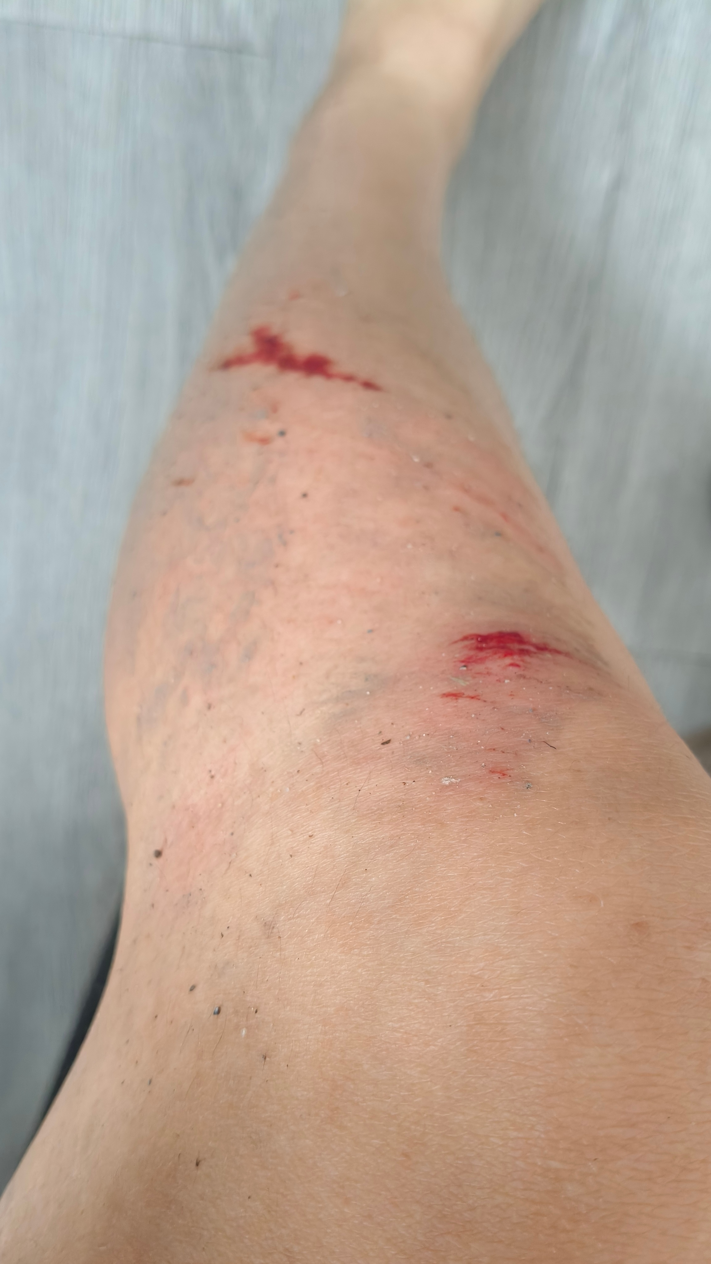 早上被撞，然后又摔了一跤 ，倒霉熊不是停播了吗