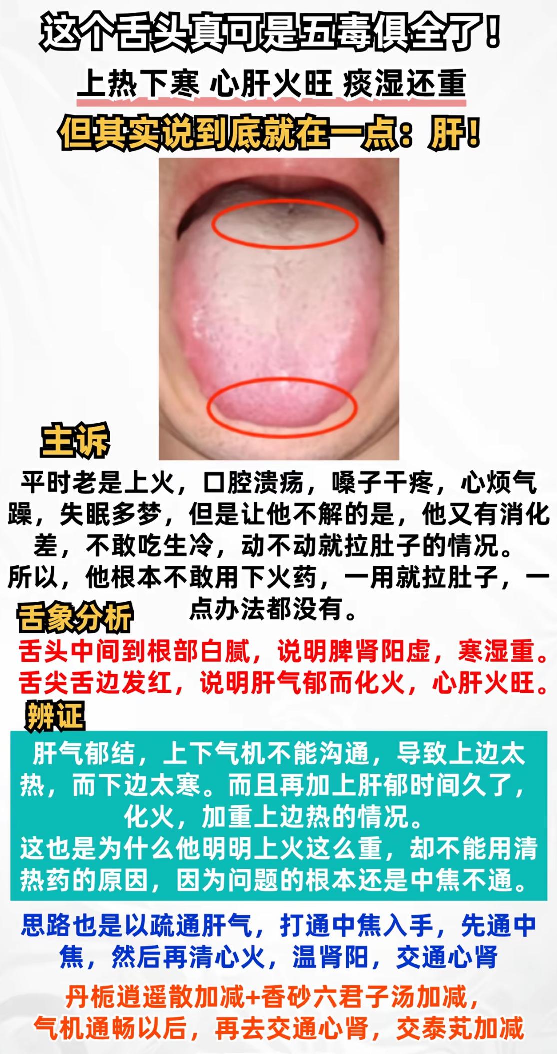 这个舌头真可是无恶不作了，上热下寒，心火旺，肝火旺，湿气重的，其实归根结底，一开