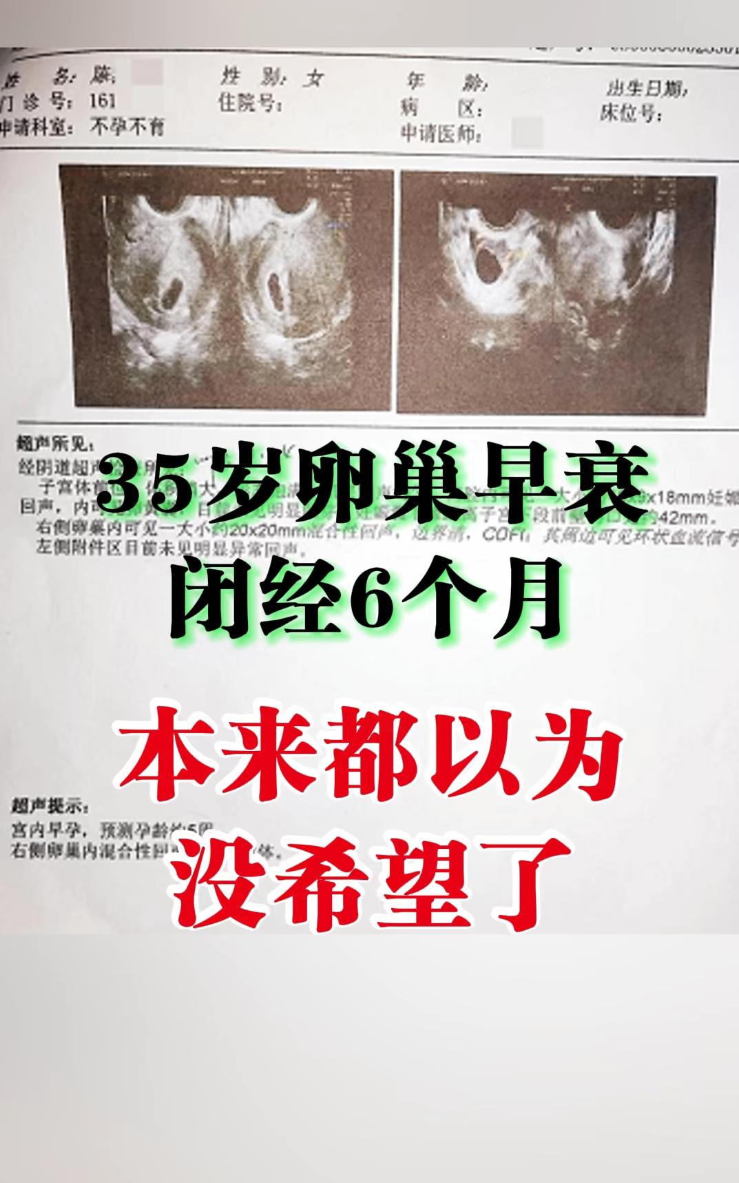 我接诊过一位35岁患者，闭经6个月，还伴有潮热盗汗、失眠烦躁、面色暗沉...