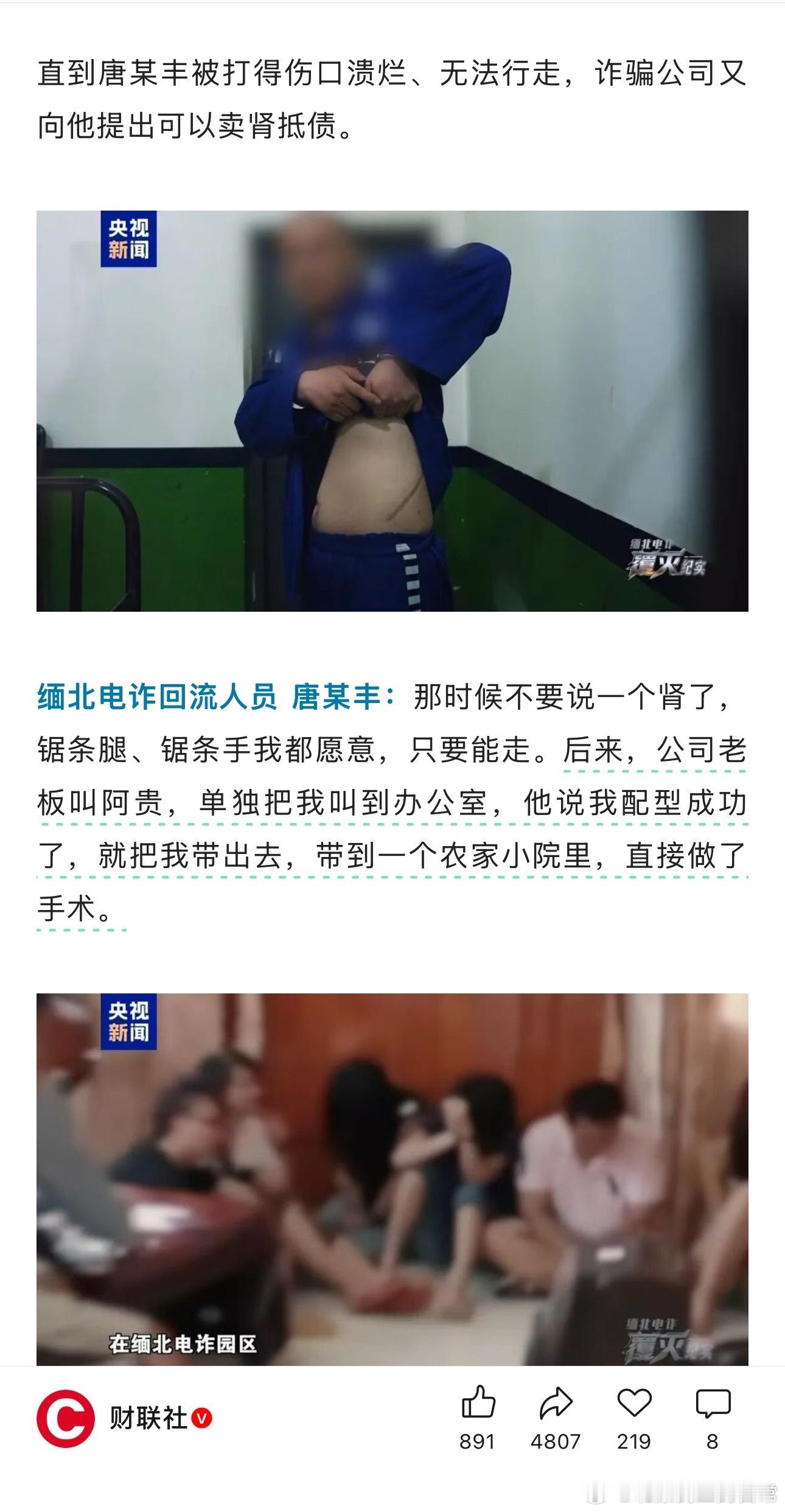 ……直到唐某丰被打得伤口溃烂、无法行走，诈骗公司又向他提出可以卖肾抵债。缅北电诈