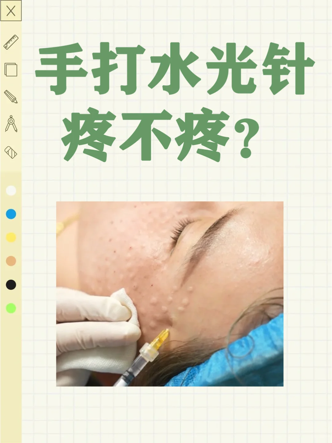 手打水光到底疼不疼？yi生告诉你~