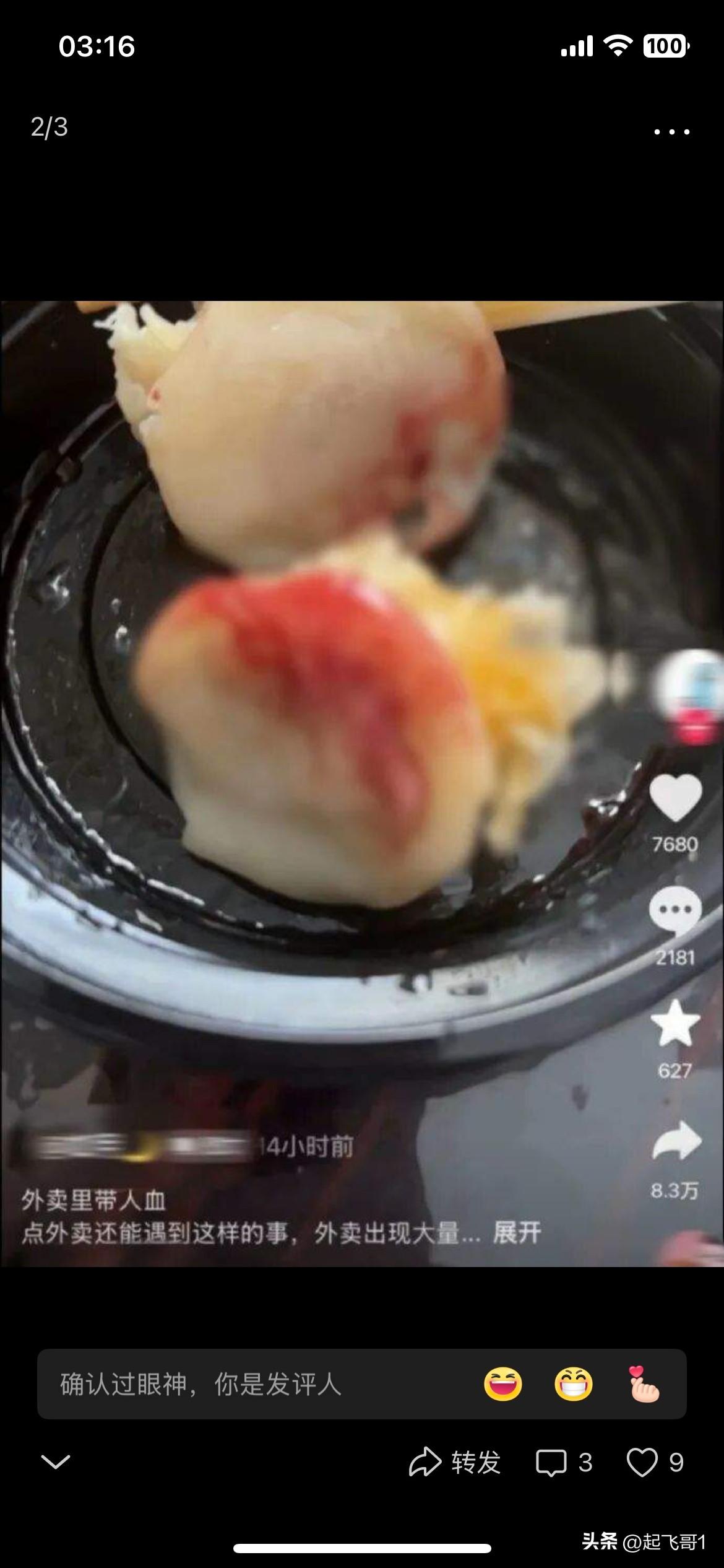 在浙江一男子在外卖平台点一份包子，在吃的过程中发现包子底部有血迹，把这男子吓坏了