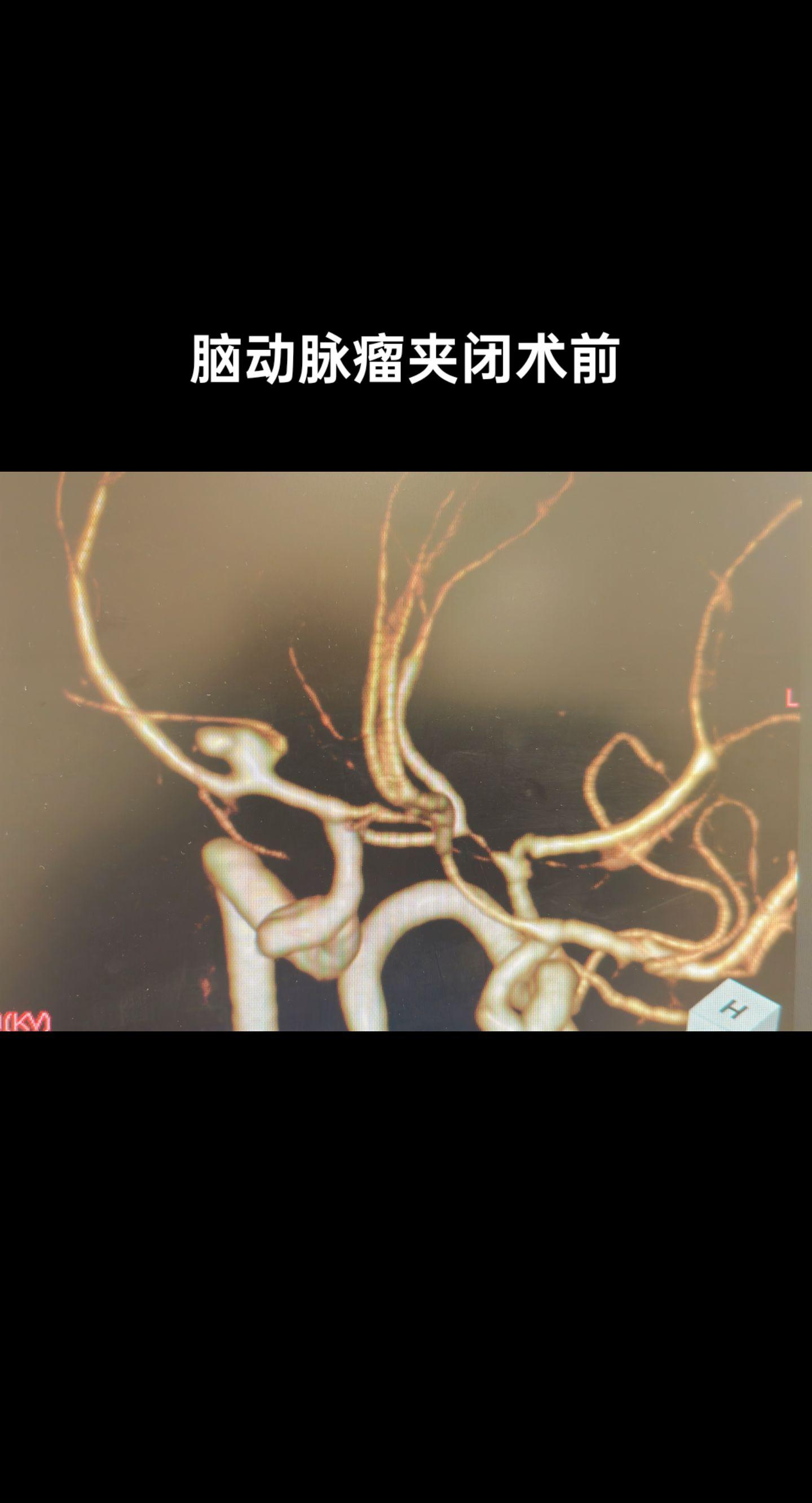 手术室日常 医学影像