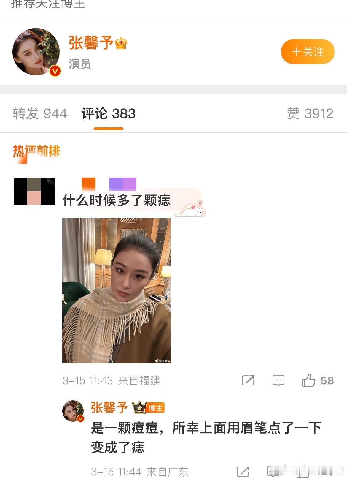 张馨予把痘痘点成痣好完美的一张脸 好完美的骨相[好爱哦]张馨予｜​​​