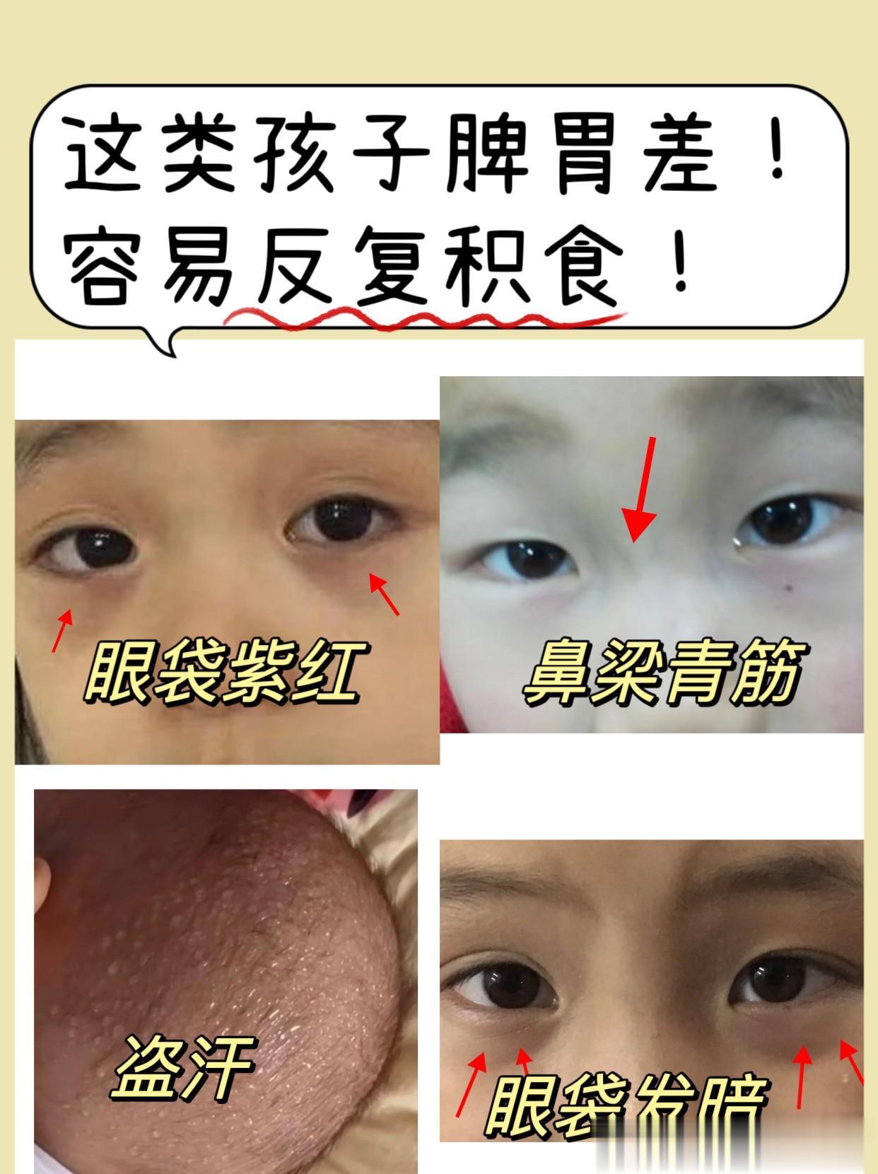 孩子经常生病，跟长期脾虚积食脱不开干系！看完这个案例你就明白了！
 
中医认为，