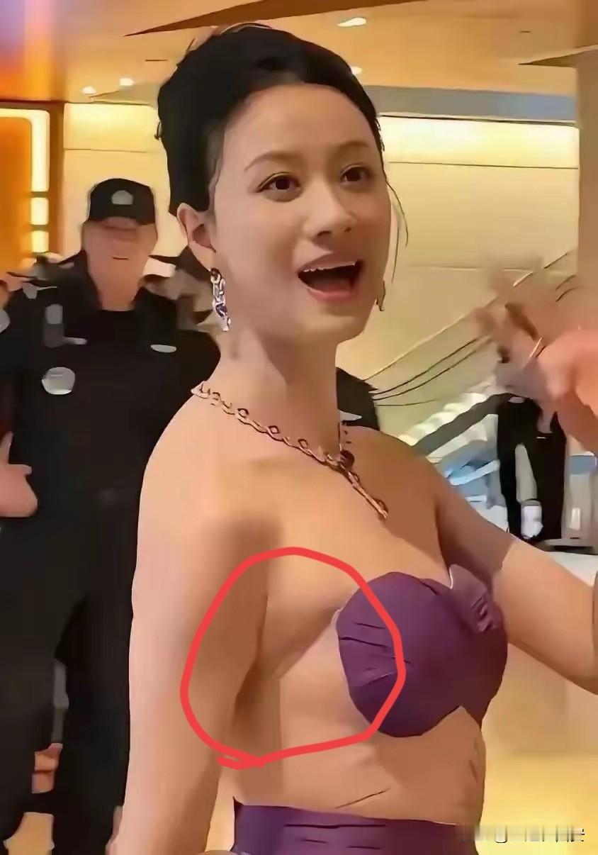 垫硅胶胸，切口要这么大？整形后，衣服外边看，美是美，但看到这疤痕印，还是蛮痛的。