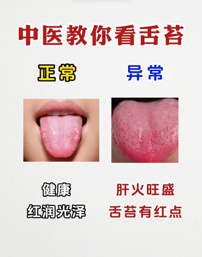 肝火、痰湿、湿热、脾虚各有舌象，看懂舌苔循序渐进调理海绵体
