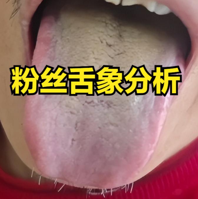 老祖宗留下的2味“黄金搭档”！活血通络补元气，我临床用了40年，帮2000多名男