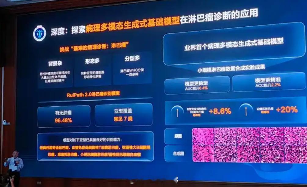 这下癌症诊断有了神助攻了！瑞金医院和华为云推出了一个病理研究的大模型。这玩意儿能