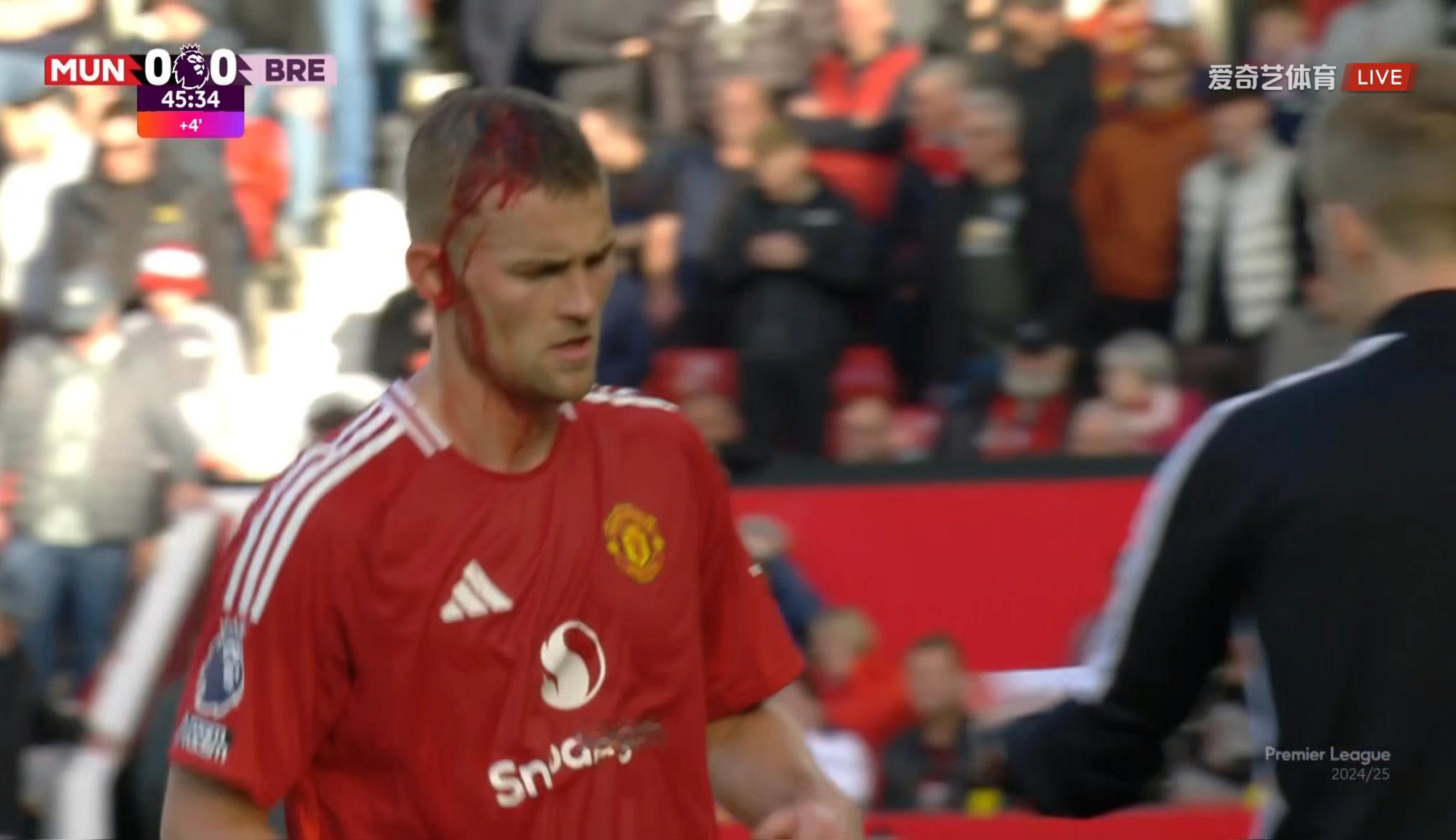 为什么不给德利赫特迅速止血[允悲]队医在干什么？00欧锦赛斯塔姆场边缝针也就几分