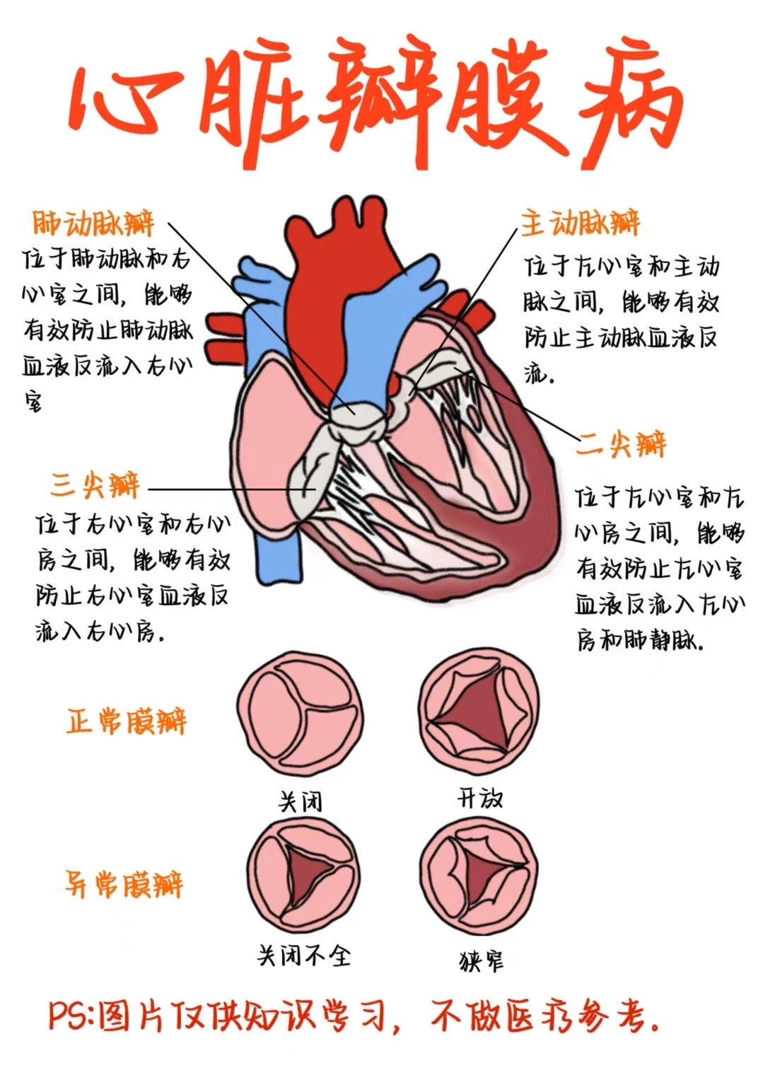 医学生笔记——心脏瓣膜病