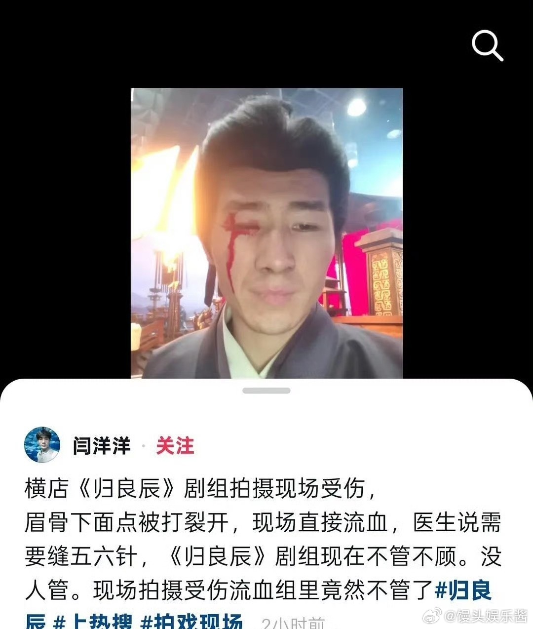 李昀锐、刘些宁《归良辰》群演眉骨受伤，需要缝五六针，剧组不管