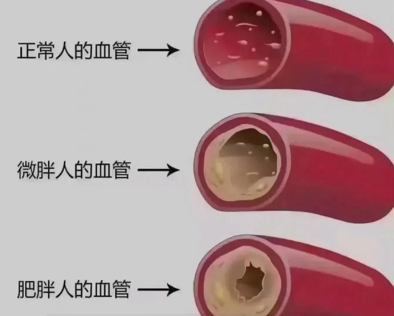 #记录我的2023#我要减肥，少盐少糖，自律起来！