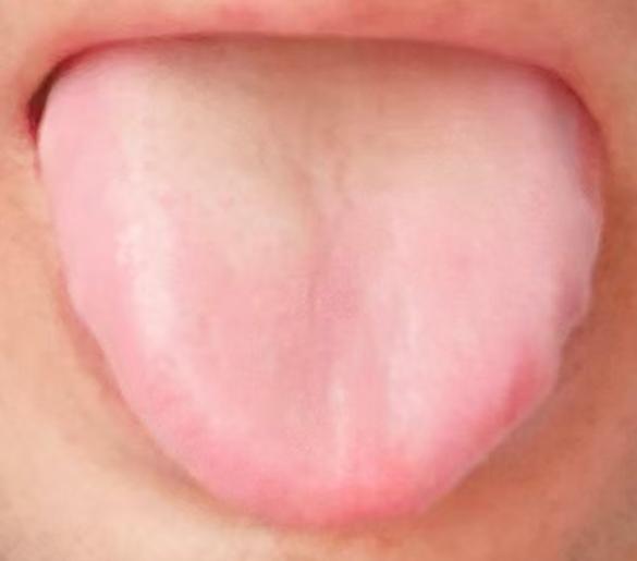 依托传统理法分层调理，循序渐进增强宗筋耐受能力






对于伤精过度出现的功