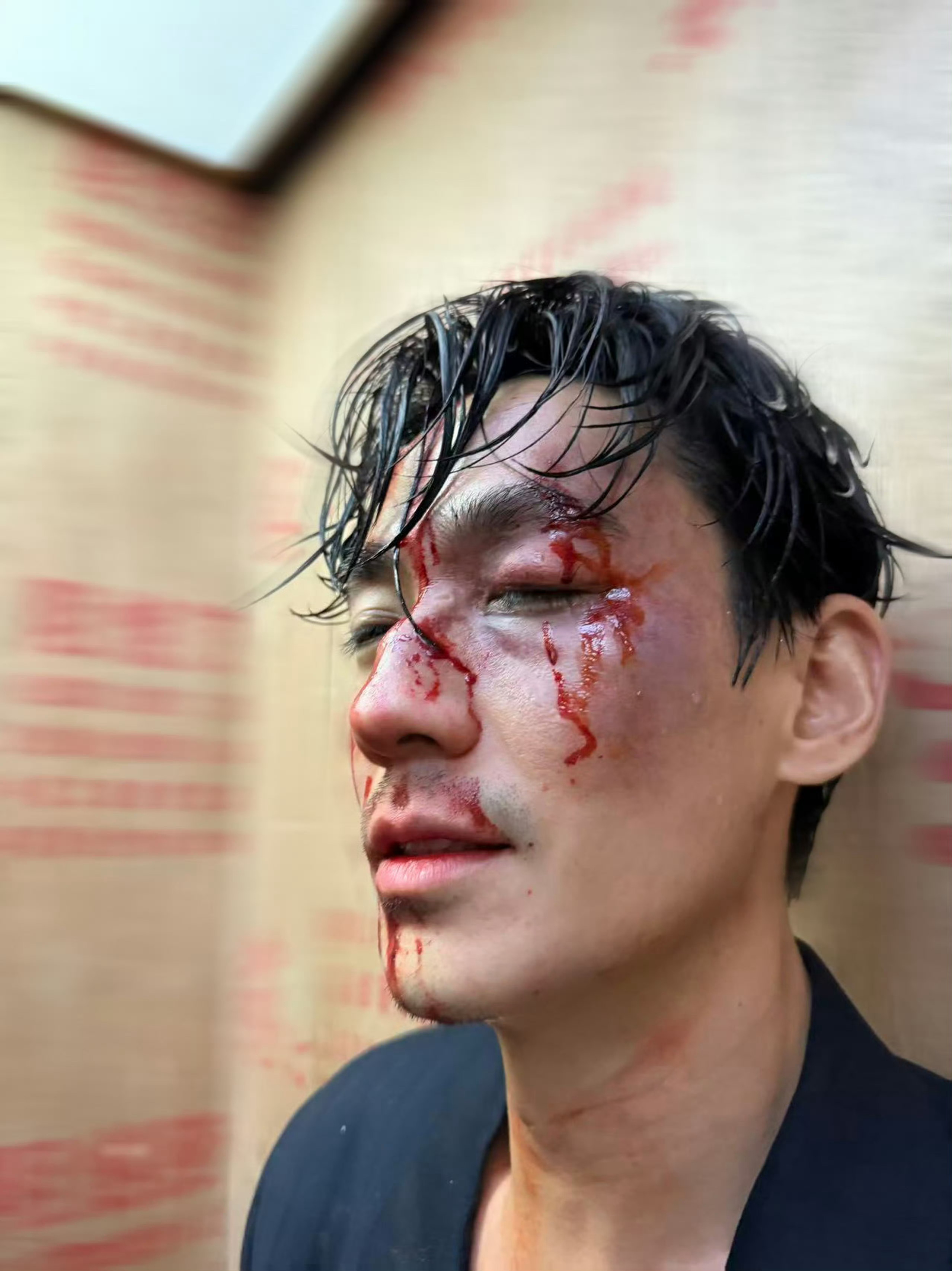 被打得鼻青脸肿还是能第一时间看到这个长睫毛[拜托] ​​​