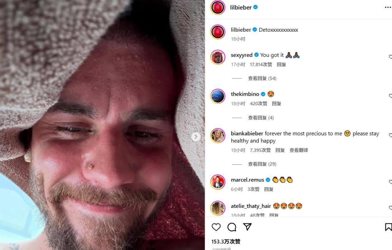 网上看到这个皮肤粗糙满脸络腮胡的鬼佬，然后告诉我这是今年31岁的贾斯汀比伯？？？