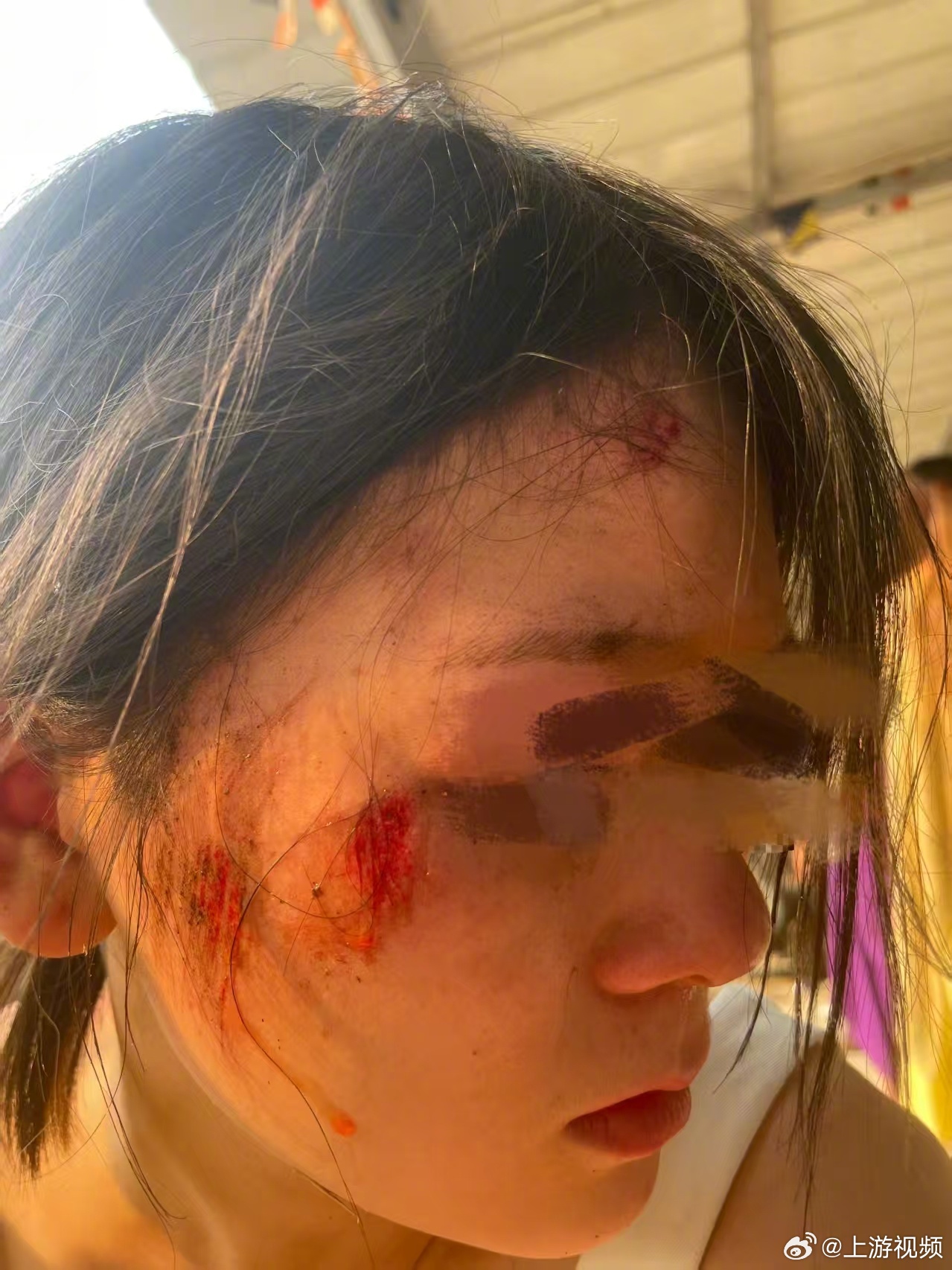 #女子称玩丛林越野刹车失灵坠崖#【女子西双版纳玩越野摔车受伤称刹车失灵，商家否认