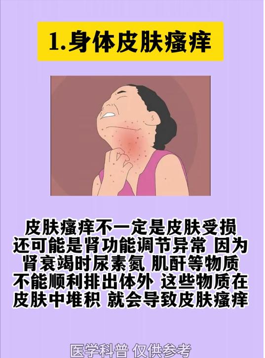 肾衰竭萌芽阶段，四种常见表现别忽视