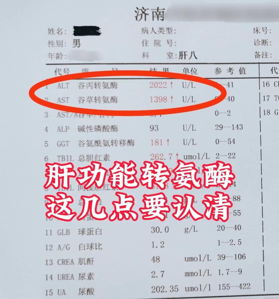 认清肝功能转氨酶这几点，对肝病治疗有帮助！ 1.转氨酶包括主谷丙转氨酶...