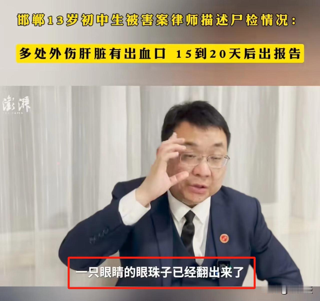 律师参与尸检说小光的一只眼睛翻出来了！
有谁和我一样天天关注这河北邯郸的三个恶魔