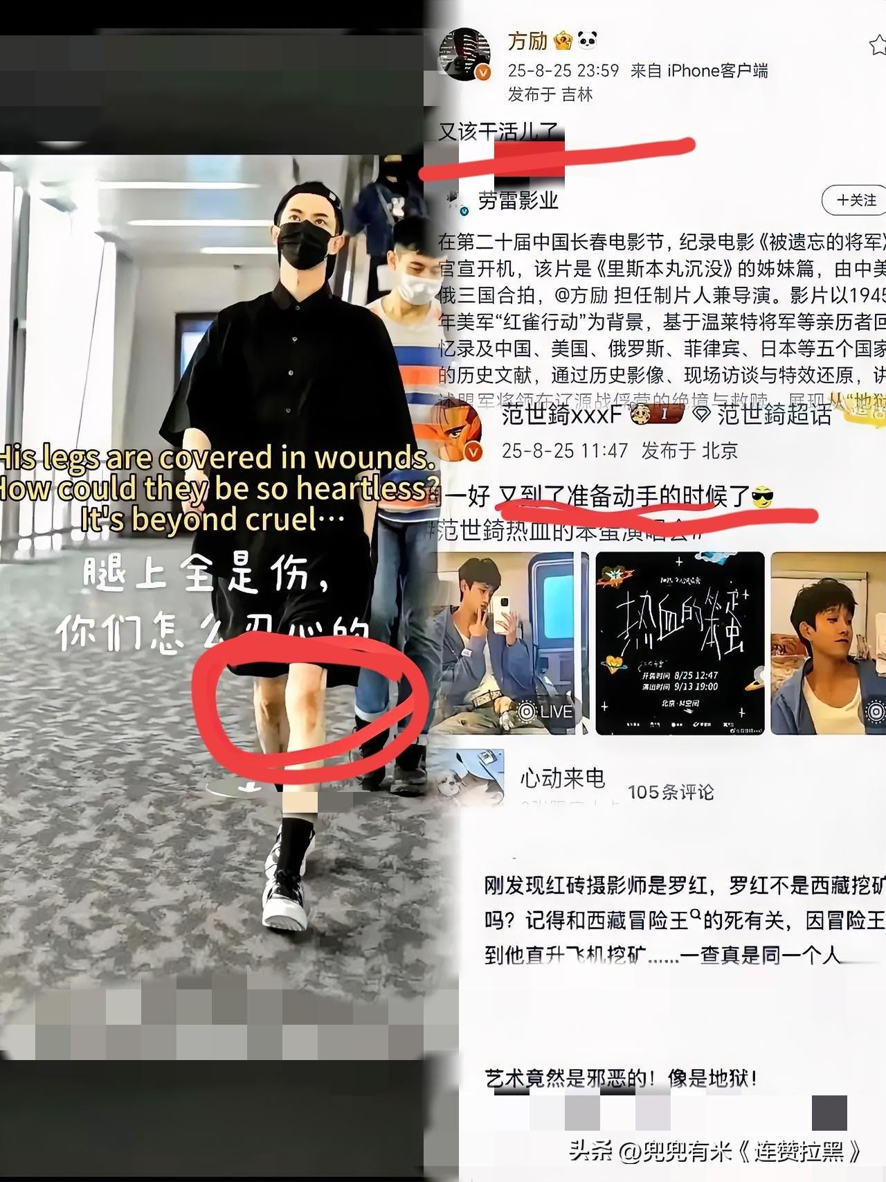 反复放大那张照片的时候，
 
心跟着揪了一下——屏幕里的淤青都透着疼！
 
之前