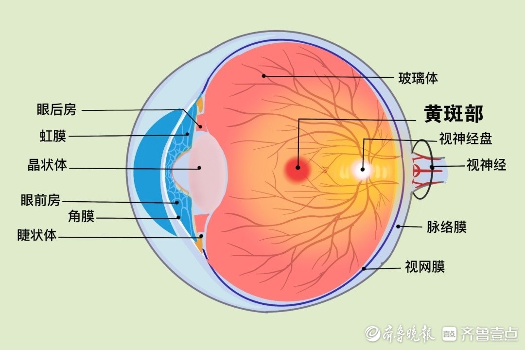 2026 年菏泽近视手术指南：4 款热门术式对比
