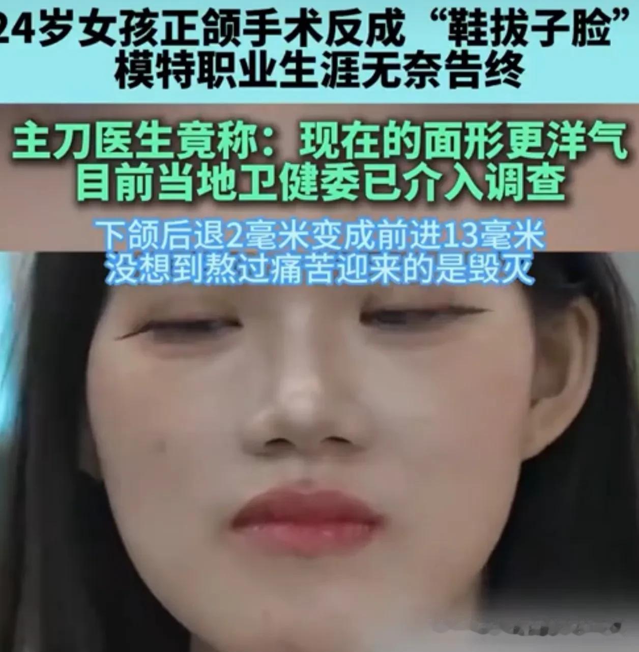 24岁女孩被“整容式”毁容！武大口腔正颌手术竟把下巴拉出13毫米，医生神回复：我