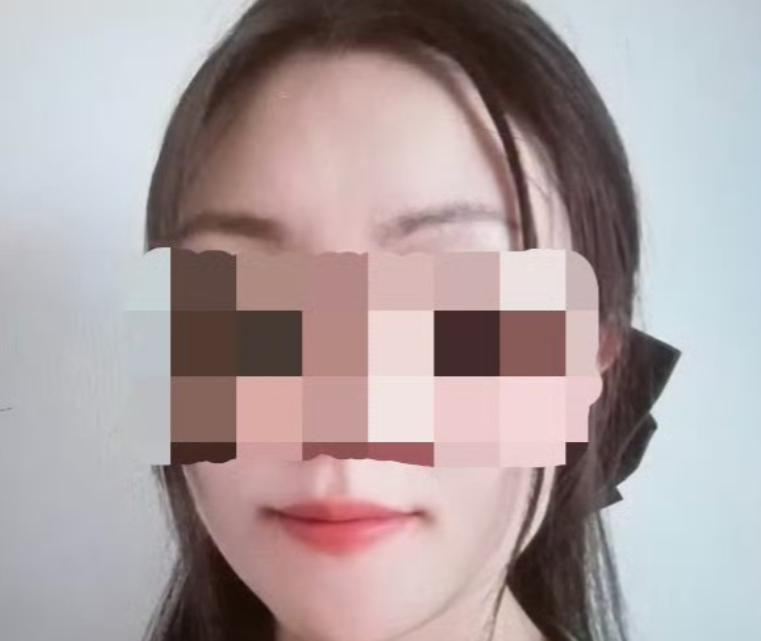 31岁中国女留学生与外国男友发生关系后，发现自己身体有红点，担心染病

20