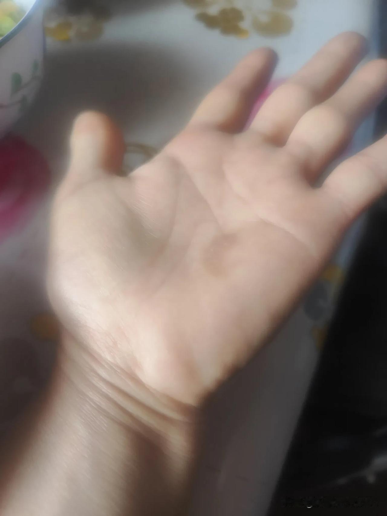最近左手掌心像老茧似的，有时还痒痒，这是什么病，用什么药唉😔😔