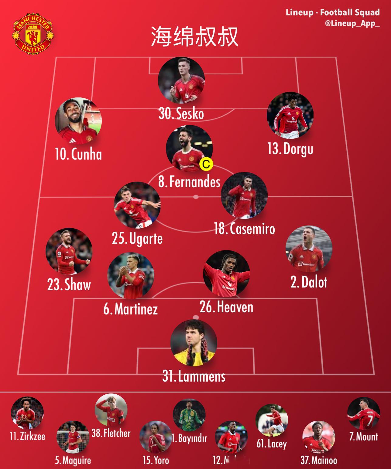 伯恩利vs曼联 我服了。中文版的首发都错了！ 