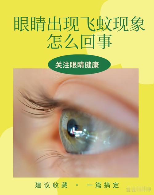 很多人都有飞蚊症，但90%的人分不清生理性和病理性！这篇科普把风险讲透了，收藏起