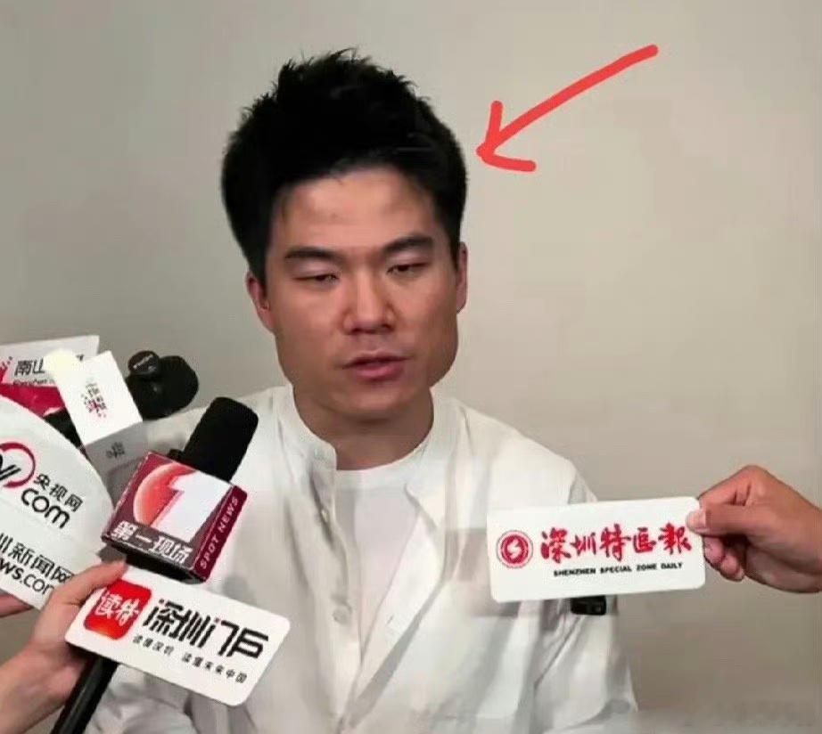 有细心的网友发现，董宇辉的伏羲骨突出，担心他的身体状况，有没有懂中医的帮忙看看呢