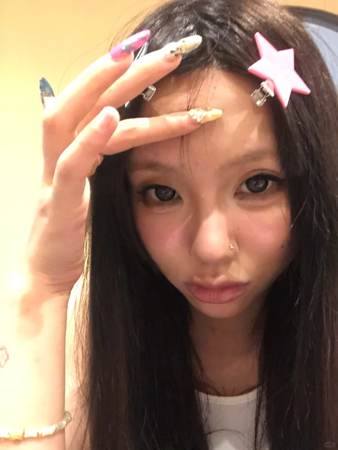 植发plog✨植发后1-7天真实体验