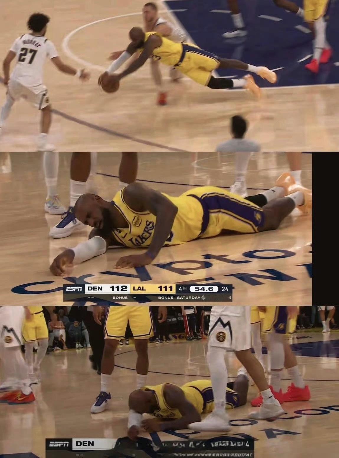 拼了老命！詹姆斯晒出他右腿上一处已经皮肤破损的伤口写道：“也许是因为那次那次年度