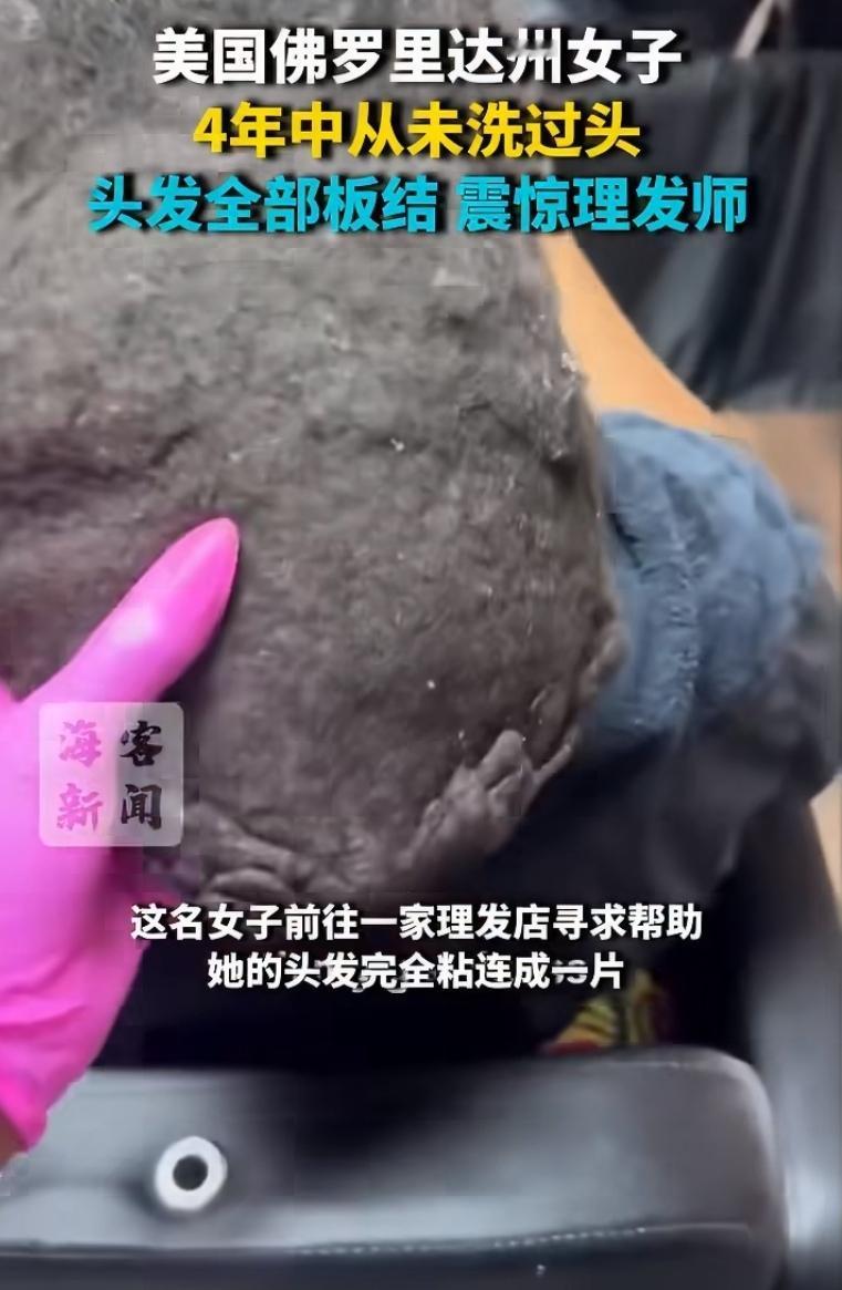 美国佛罗里达，女子超过4年没洗头，头发完全粘连成一片，像板砖一样硬。理发师看到直