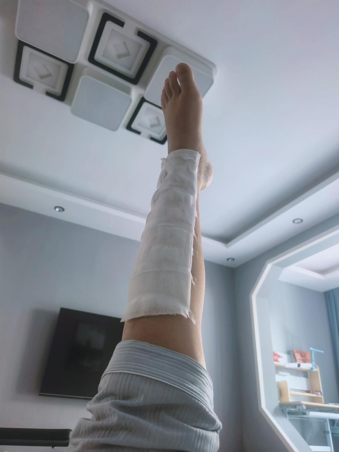 说骨折消肿得抬高高于心脏。我都举一天了。