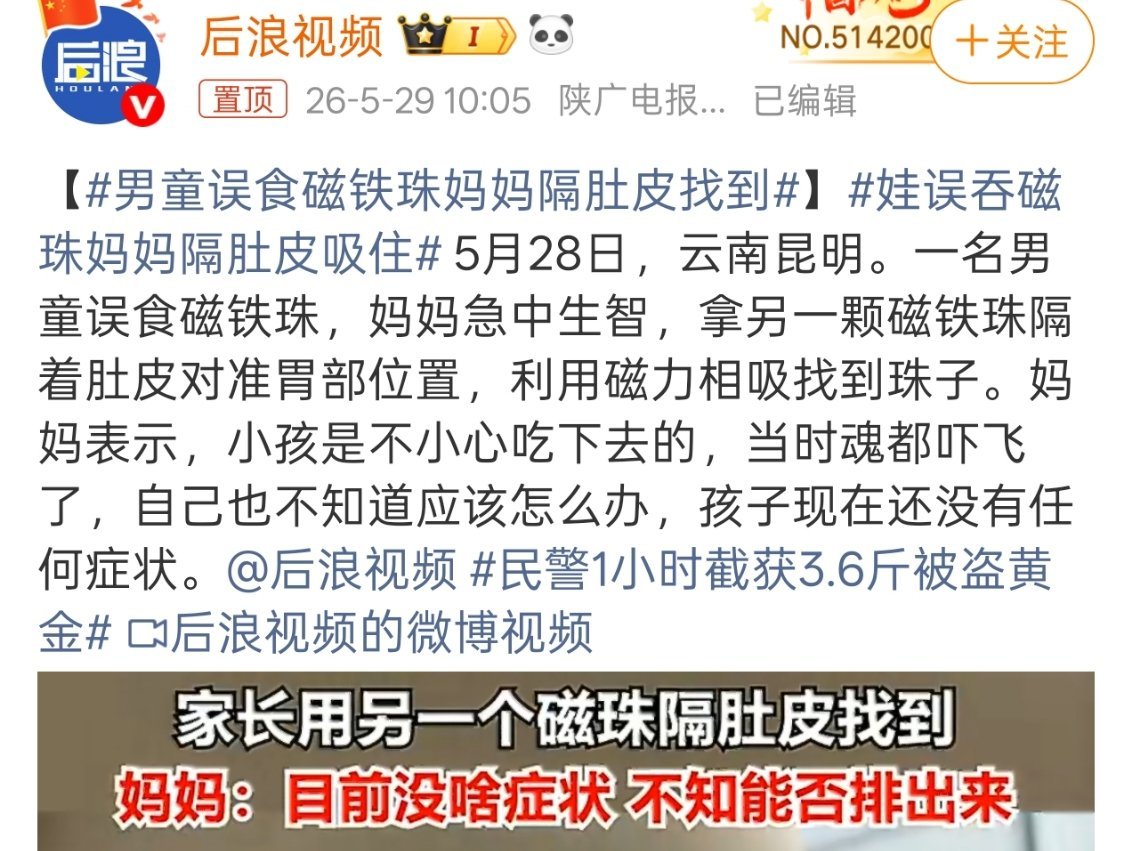 男童误食磁铁珠妈妈隔肚皮找到所以带小孩子是真的费心，无时无刻不得盯着，啥东西都能