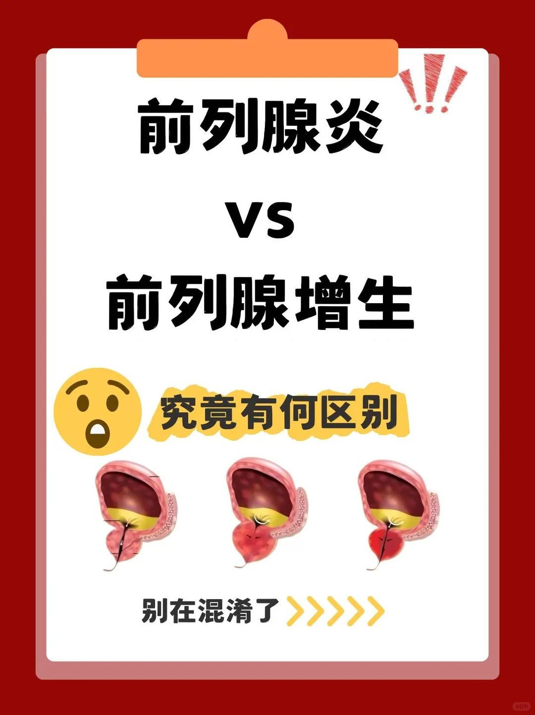 前列腺增生和前列腺炎有关系？