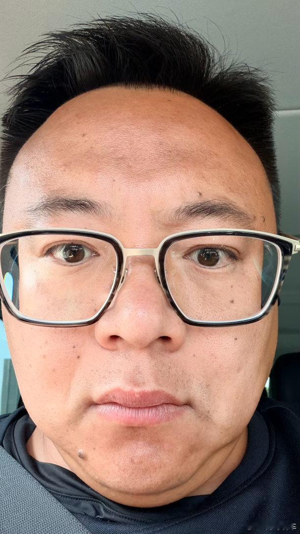 你们可能从照片上看不出来我这两天晒太阳晒的想印度阿三真的太黑了 法国