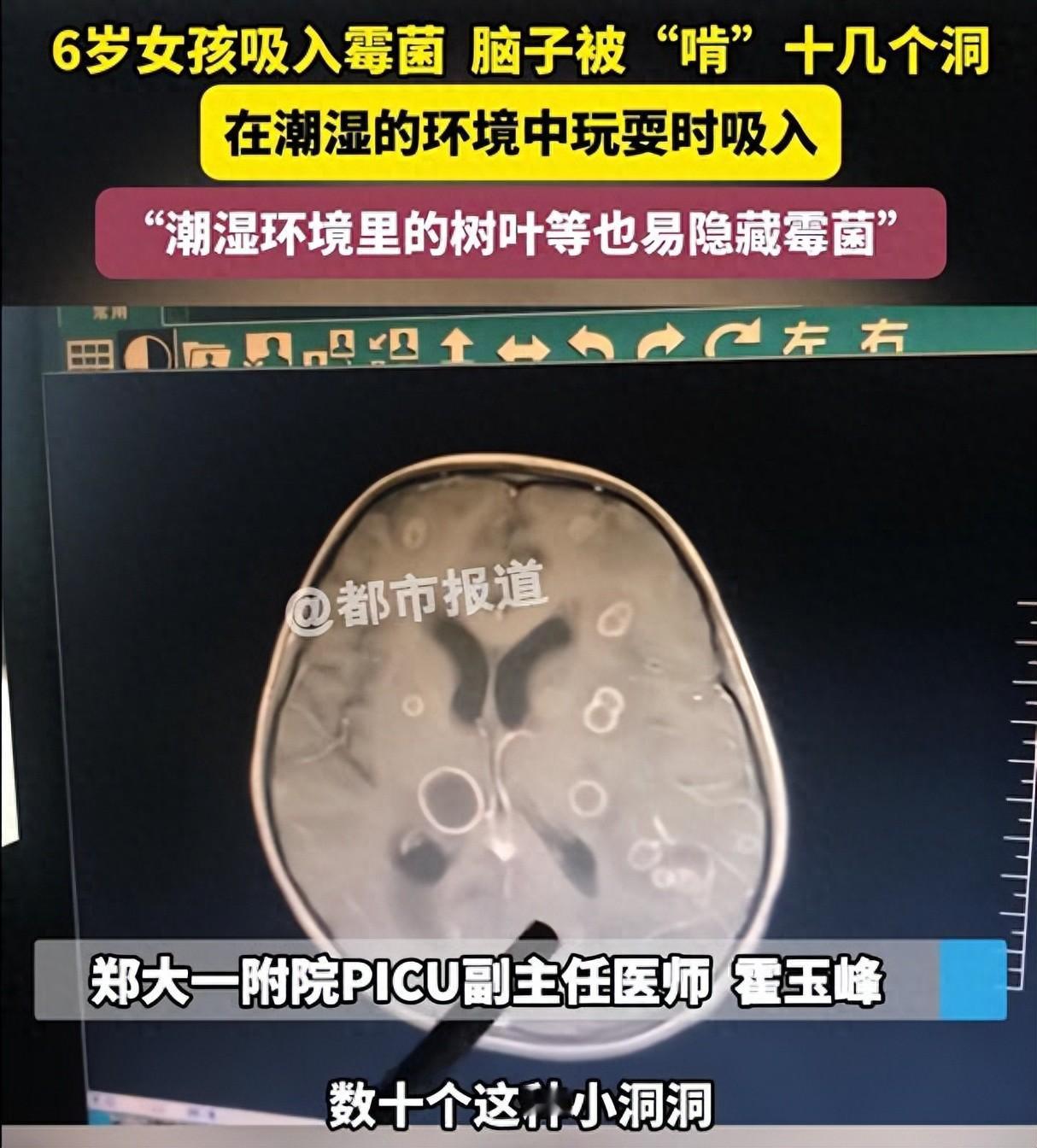 家里出现了这种东西一定要赶紧处理掉，平时还要勤开窗通风。
6岁的小女孩发烧17天