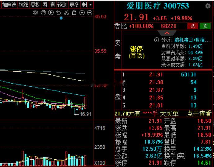 脑机接口消息刺激多看两天，不要问今天还能不能追财经a股