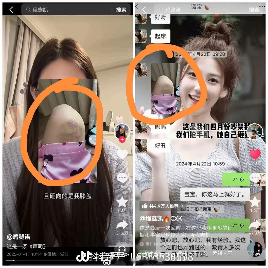 篮球网红程鑫凯家暴女友鸡腿诺出现反转！程鑫凯晒出鸡腿诺的聊天记录彻底把她打败了，