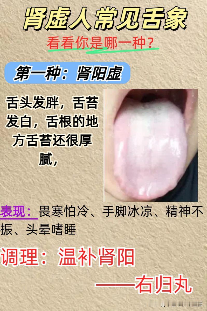 肾虚的人常见四种舌象，对照一下你是哪一种？

一：肾阳虚
二：肾阴虚
三：肾气虚